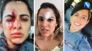 Soldado da PM é agredida e ferida por mulher durante abordagem em Mantenópolis