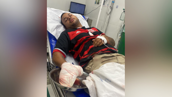 Torcedor do Flamengo tem mão dilacerada em acidente com fogos de artifício em Boa Esperança, no ES